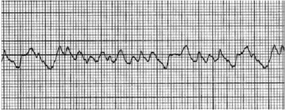 ACLS Exam - Free Actual Q&As, Page 2 | ExamTopics