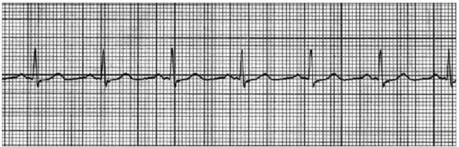 ACLS Exam - Free Actual Q&As, Page 19 | ExamTopics